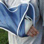 broken-arm-1435980[1]
